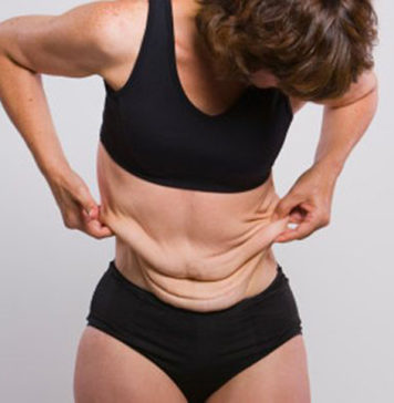 MINUTO BELEZA com Stephanie João | Flacidez